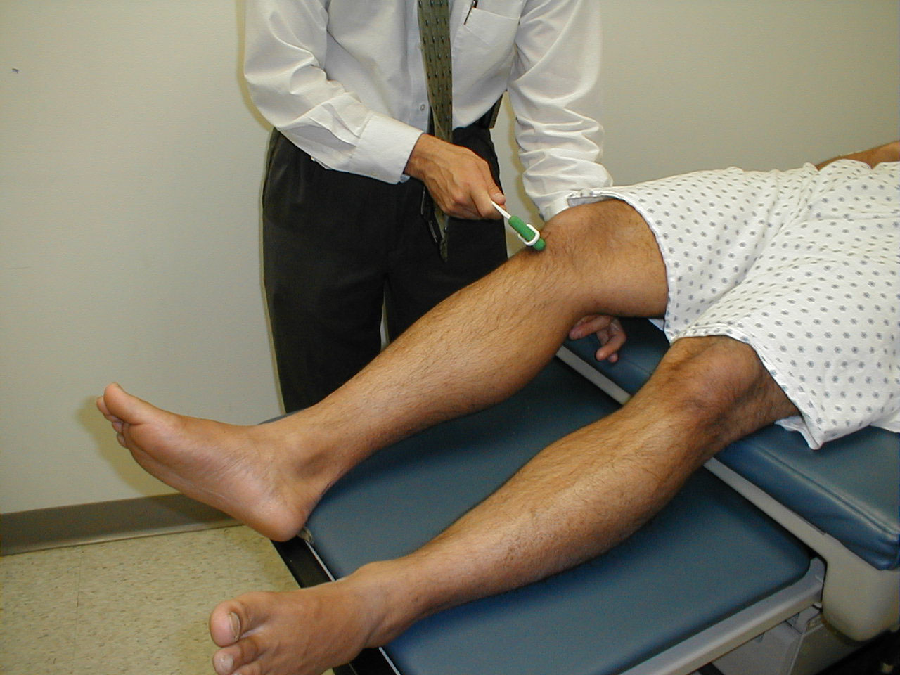 Deep Tendon Reflex DTR Examination