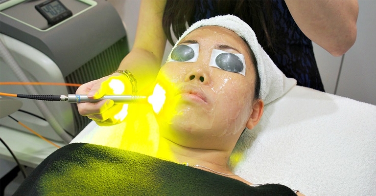 Yellow Laser Therapy