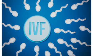 IVF treatment